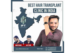 affordable hair transplant clinic Rajasthan